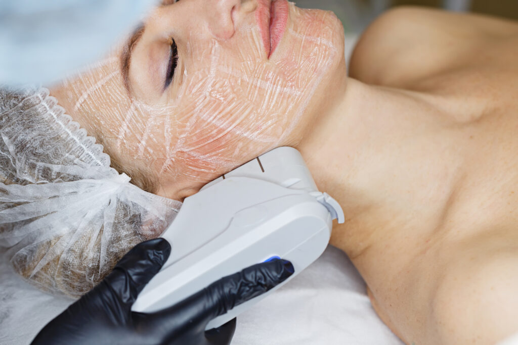Laser ou bioestimulador: qual é o melhor procedimento?